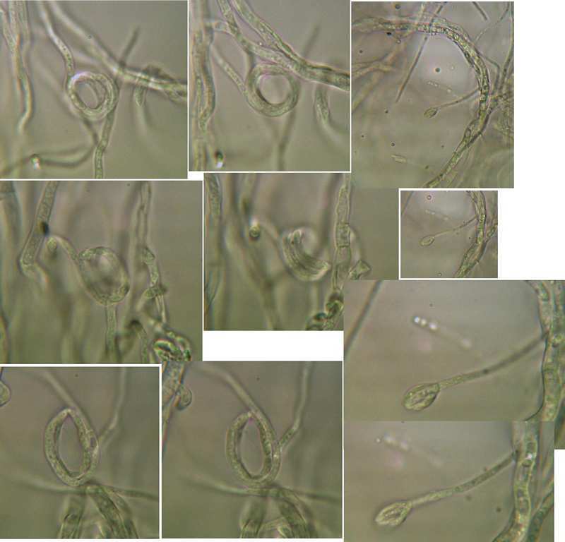 |Pure cultures of Calyptellopsis reticulata, PP20080115-c01, 7days MEA